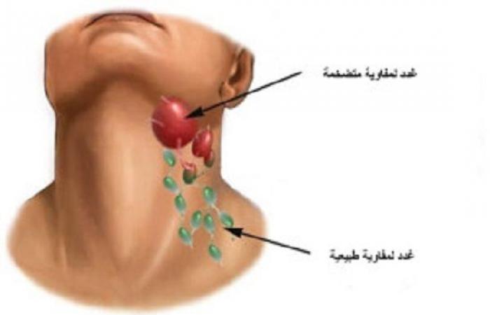 حسام موافي: الغدد اللمفاوية خط الدفاع الأول ضد الأمراض والالتهابات