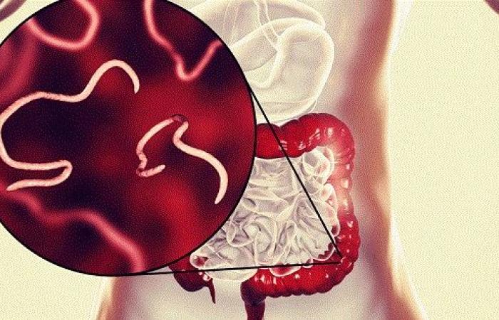 نصائح لحماية طفلك من الإصابة بالديدان الدبوسية